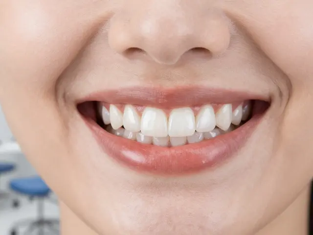 Co bělí zuby? Všechno, co potřebujete vědět o fazetách na přední zuby