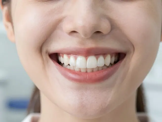 Zubní fazety: Jak získat bílejší zuby s trvalým efektem