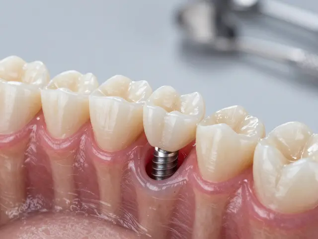 Zubní implantáty vs. můstky: Která volba vám skutečně vyhovuje?