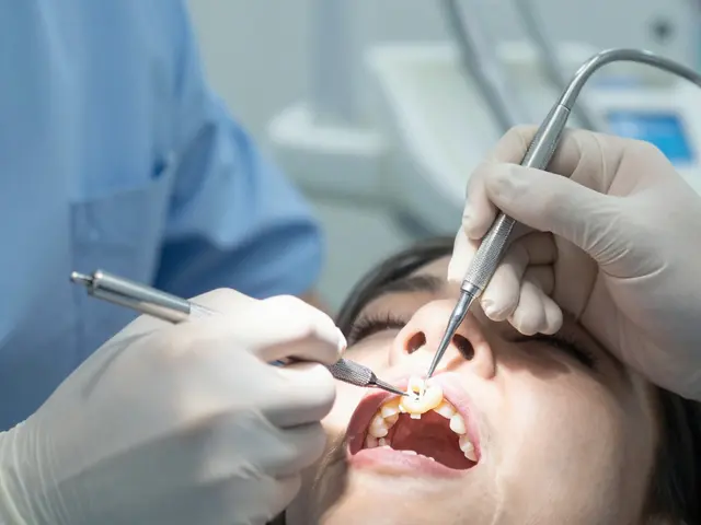 Jak dlouho trvá nasazení korunky na zub? Průběh a časový plán