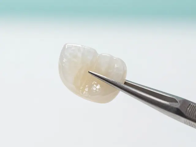 Estetické fazety: Vše, co vás zajímá o úsměvu z porcelánu