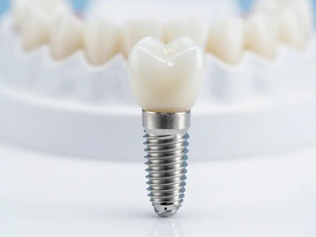 Jak dlouho vydrží zubní implantáty? Pravda o životnosti a péči