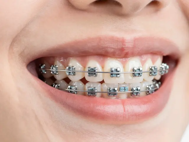 Jak se vyhnout zničeným zubům po rovnátkách: 10 prověřených tipů