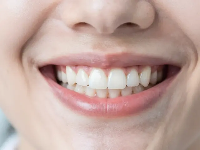 Jak zabránit tvorbě mezer mezi zuby: Průvodce prevencí a péčí