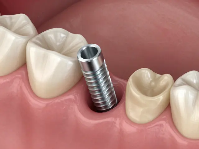 Jak probíhá proces hojení po zákroku zubních implantátů: Kompletní průvodce